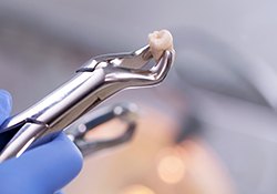 Nose-to-chest view of a woman giving thumbs up and holding extracted tooth